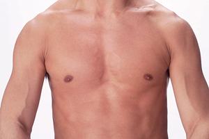 【最新版】池袋で選ぶ医療脱毛の効果と安心を叶えるクリニック徹底比較