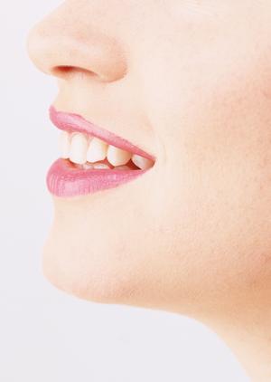 太田母斑の治療を実施するところ